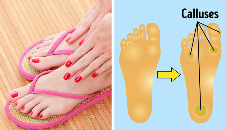 6 Types of Shoes That are Bad For Your Body