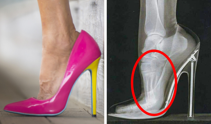 6 Types of Shoes That are Bad For Your Body
